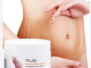 MELAO Stretch Mark Cream for Pregnancy & Scar Removal – 120G
