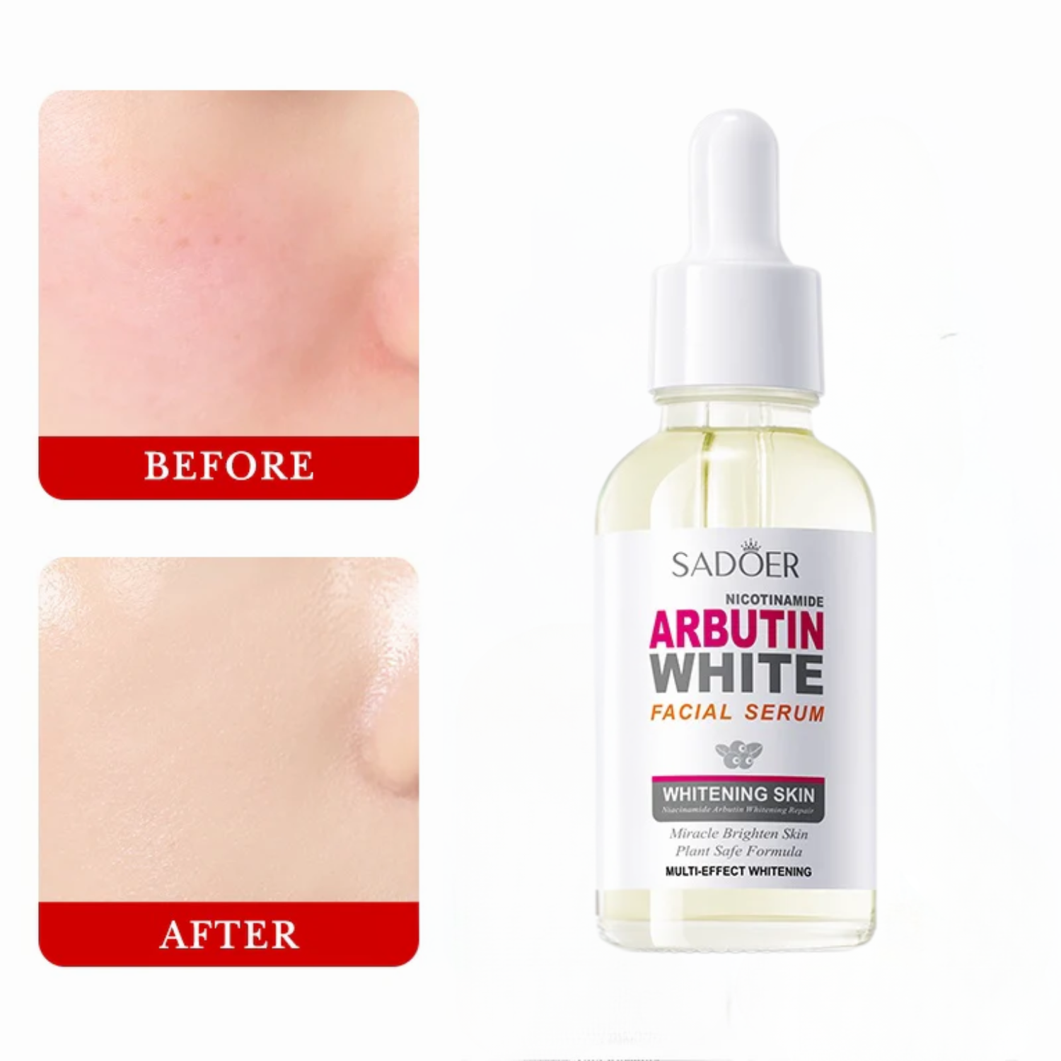 1044737_sadoer-nicotinamide-arbutin-facial-serum-30ml (1)