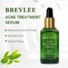 1199381_breylee-acne-treatment-serum-17ml (1)